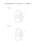 SURGICAL JIG, VERIFICATION JIG, AND METHODS FOR PRODUCING THESE JIGS diagram and image