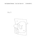 SURGICAL JIG, VERIFICATION JIG, AND METHODS FOR PRODUCING THESE JIGS diagram and image