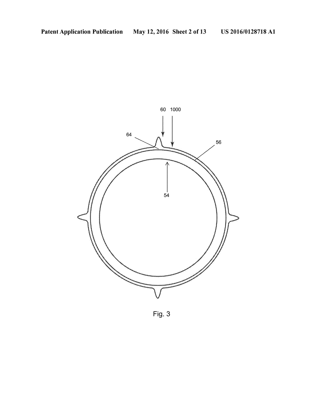 MEDICAL BALLOON - diagram, schematic, and image 03