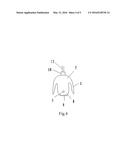 STRESS-DISPERSING FIXING AND CONNECTING APPARATUS FOR ANTERIOR SUPERIOR     ILIAC SPINE AND ILIAC CREST diagram and image