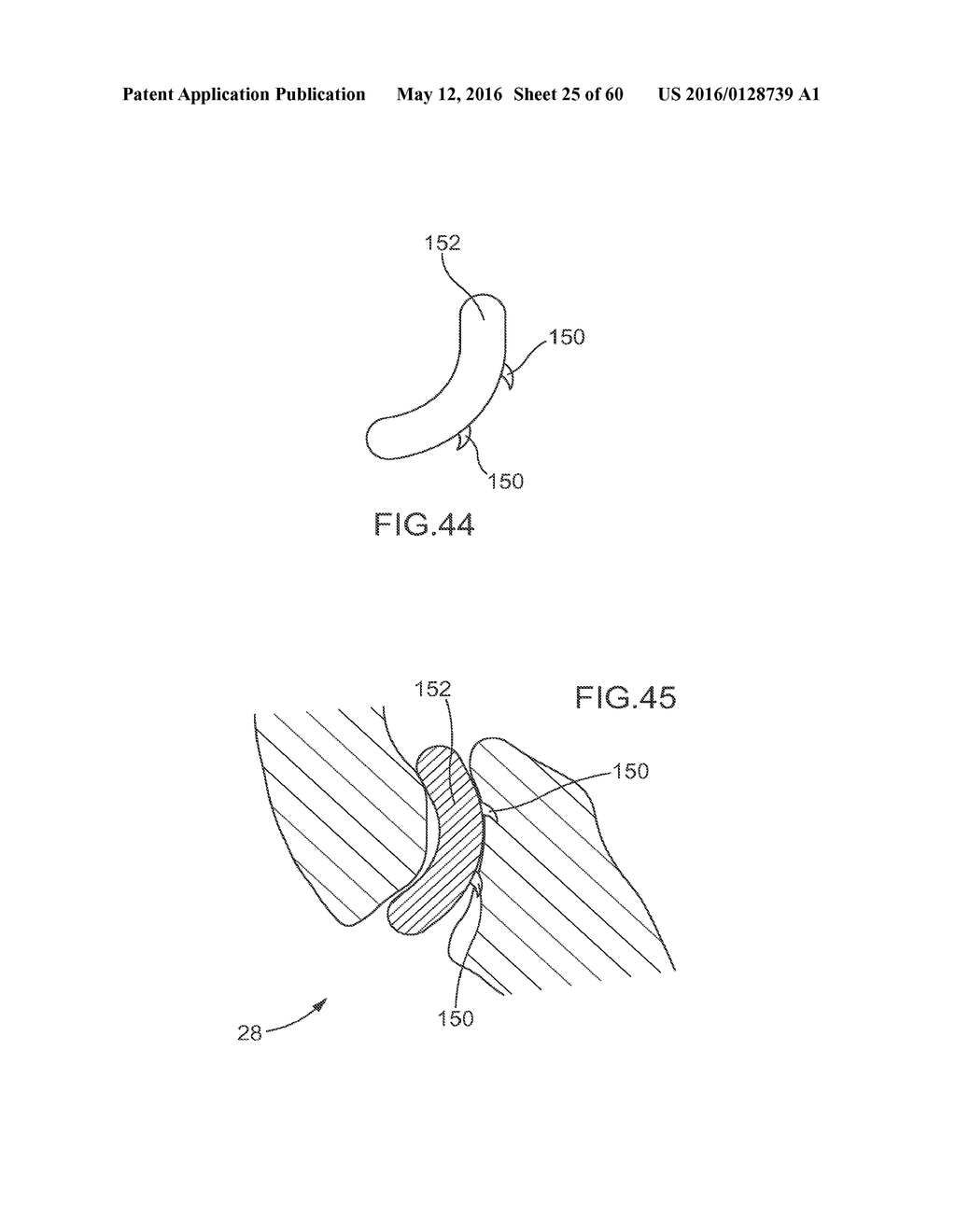 VERTEBRAL FACET JOINT FUSION IMPLANT AND METHOD FOR FUSION - diagram, schematic, and image 26