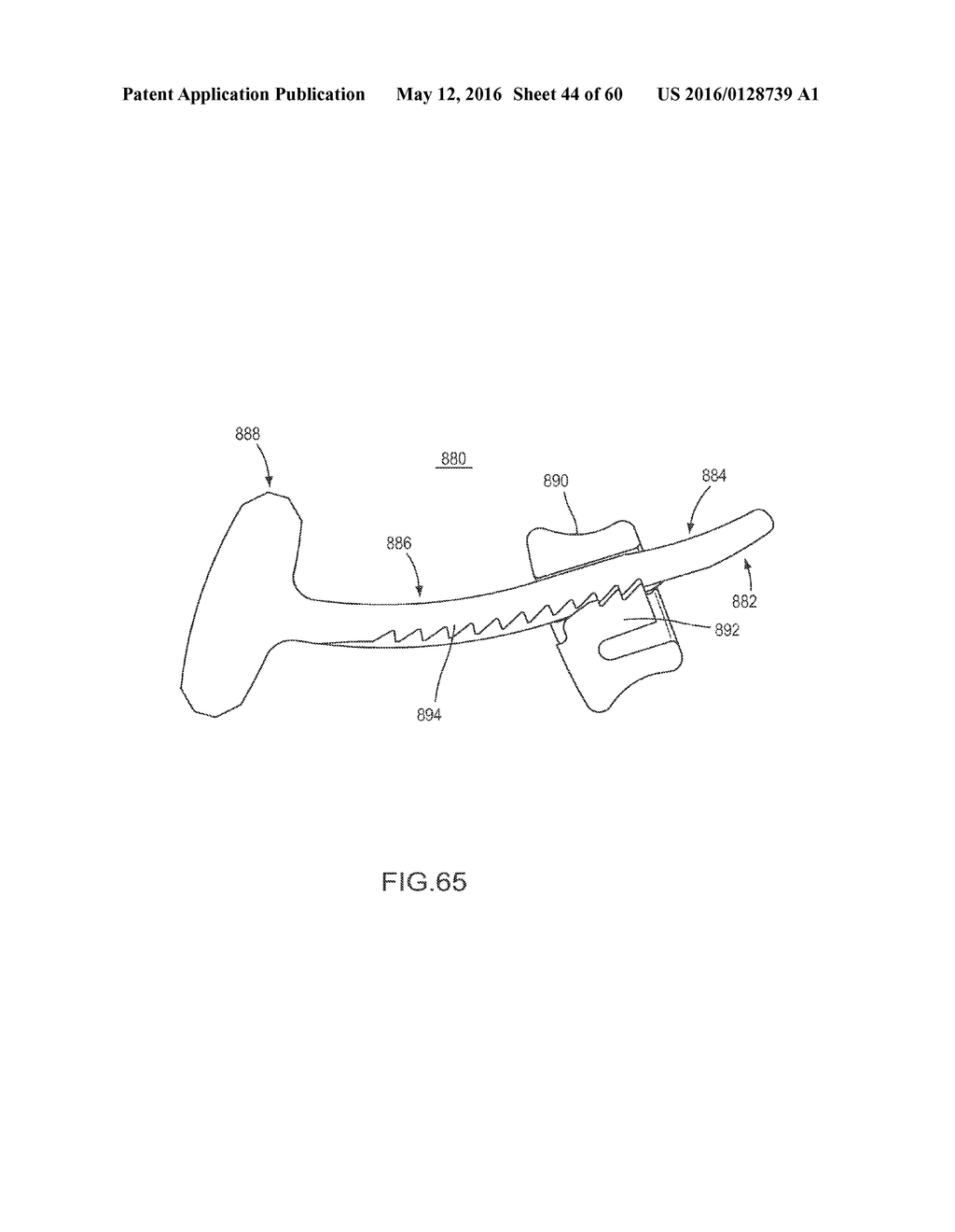 VERTEBRAL FACET JOINT FUSION IMPLANT AND METHOD FOR FUSION - diagram, schematic, and image 45