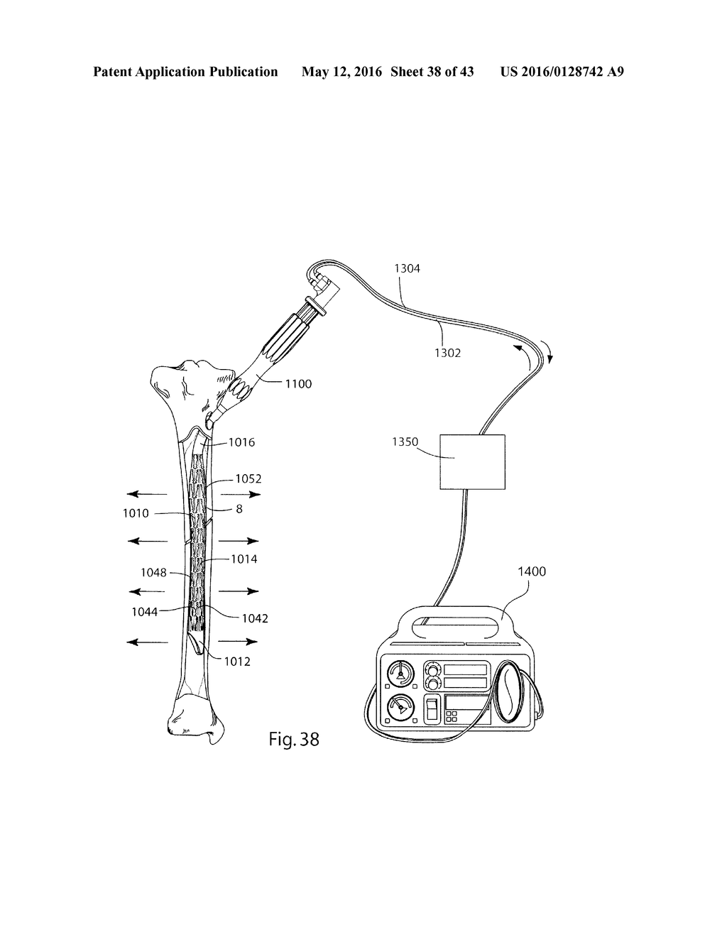 BONE STABILIZATION DEVICE AND METHOD - diagram, schematic, and image 39