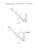 Femoral Neck Fracture Implant diagram and image