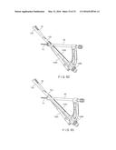 Femoral Neck Fracture Implant diagram and image