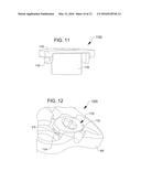 POLYAXIAL BONE PLATE AND LOCKING ASSEMBLY diagram and image