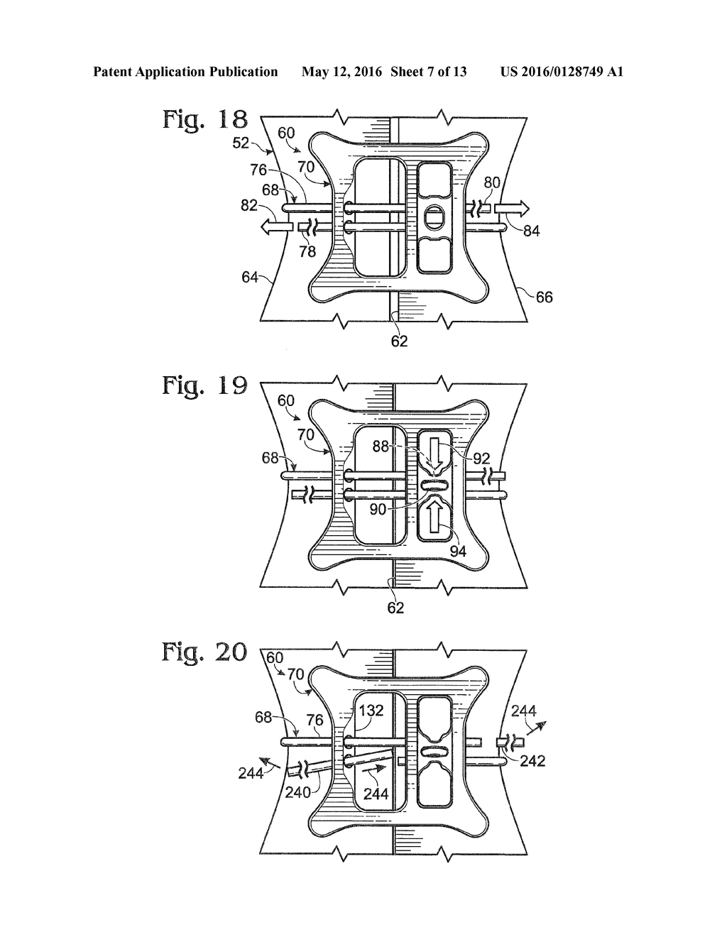 SYSTEM FOR BINDING BONE - diagram, schematic, and image 08