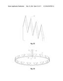 OPHTHALMIC SURGICAL DEVICE FOR CAPSULOTOMY diagram and image