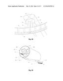 OPHTHALMIC SURGICAL DEVICE FOR CAPSULOTOMY diagram and image