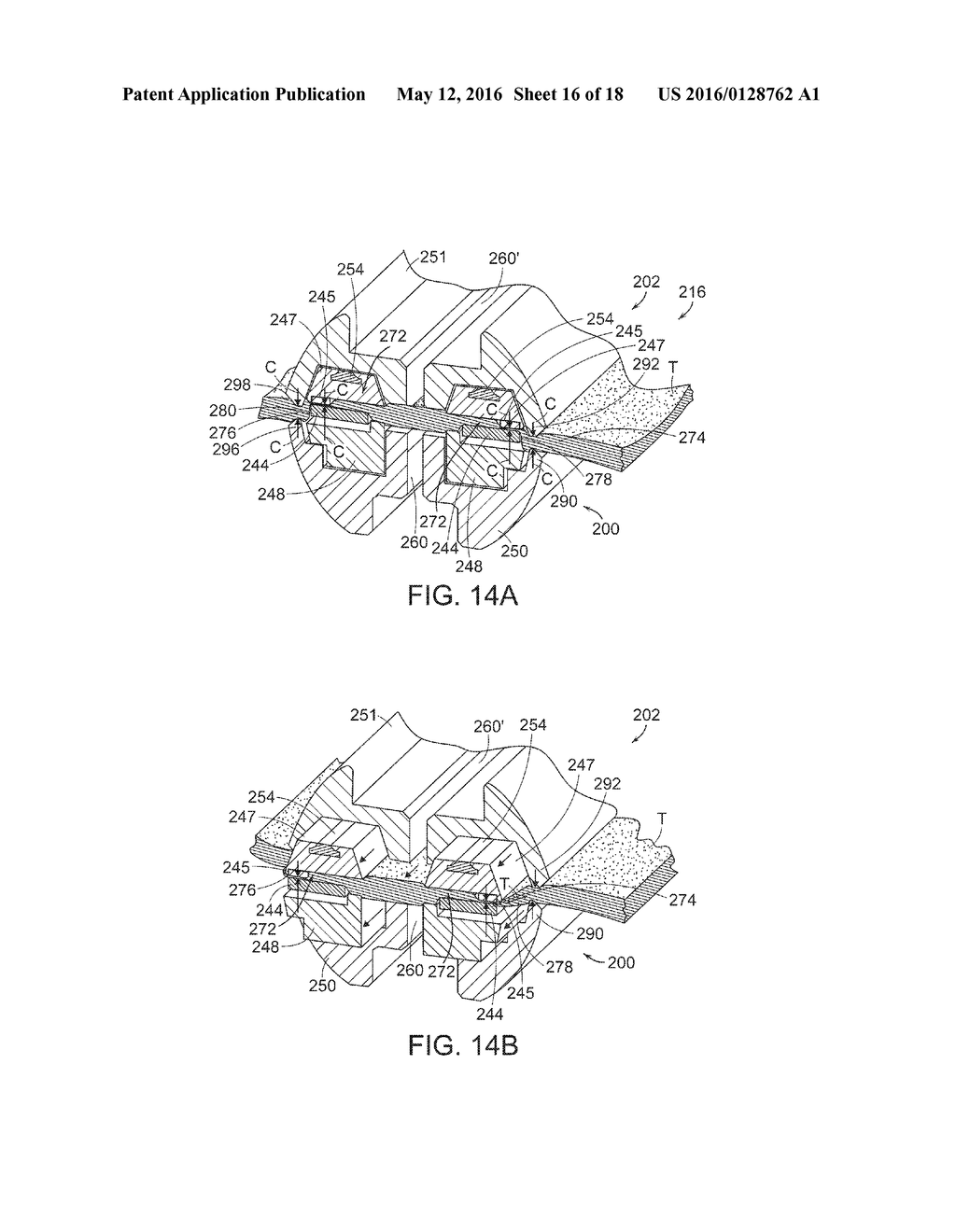 SURGICAL INSTRUMENTS FOR TENSIONING TISSUE - diagram, schematic, and image 17