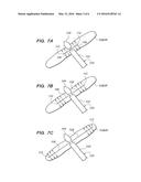 TISSUE ABLATION PROBES AND METHODS FOR TREATING OSTEOID OSTEOMAS diagram and image