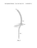 CATHETER WITH ADJUSTABLE ARCUATE DISTAL SECTION diagram and image