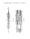 CATHETER WITH ADJUSTABLE ARCUATE DISTAL SECTION diagram and image