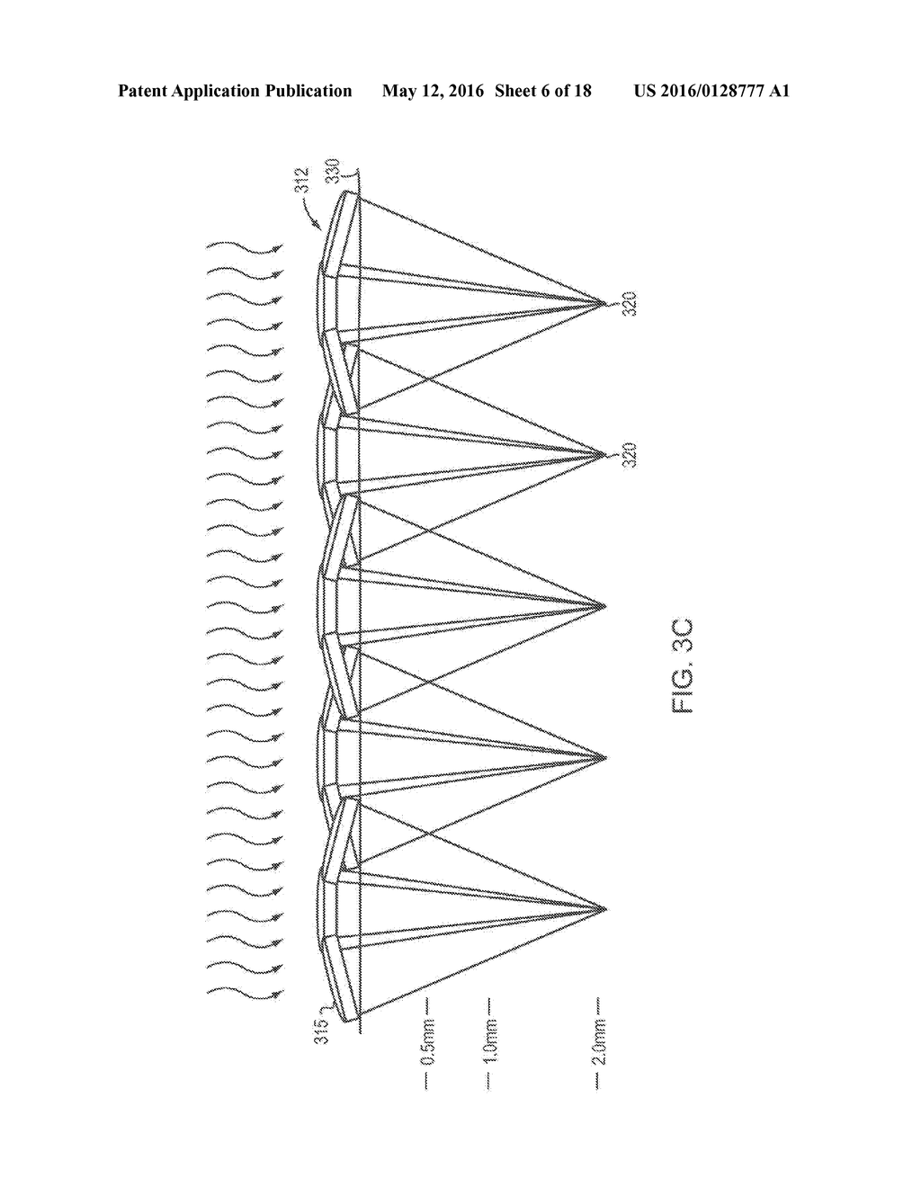 Controlled Photomechanical and Photothermal Treatment of Mucosal Tissue - diagram, schematic, and image 07