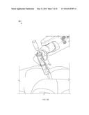 NOTCHED APPARATUS FOR GUIDANCE OF AN INSERTABLE INSTRUMENT ALONG AN AXIS     DURING SPINAL SURGERY diagram and image