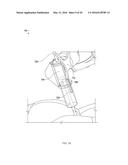 NOTCHED APPARATUS FOR GUIDANCE OF AN INSERTABLE INSTRUMENT ALONG AN AXIS     DURING SPINAL SURGERY diagram and image