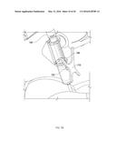 NOTCHED APPARATUS FOR GUIDANCE OF AN INSERTABLE INSTRUMENT ALONG AN AXIS     DURING SPINAL SURGERY diagram and image