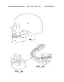 SYSTEM FOR DETERMINING FINAL POSITION OF TEETH diagram and image