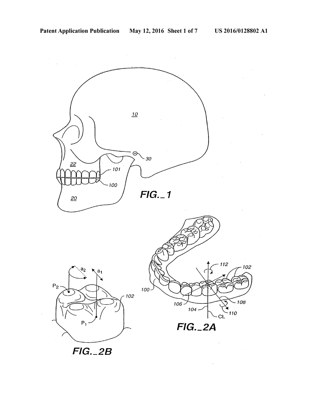 SYSTEM FOR DETERMINING FINAL POSITION OF TEETH - diagram, schematic, and image 02