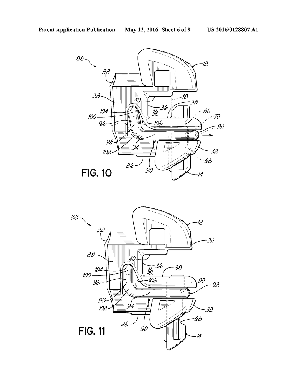 ORTHODONTIC BRACKET HAVING A LINGUALLY BIASED CLOSURE MEMBER AND     ASSOCIATED METHOD - diagram, schematic, and image 07