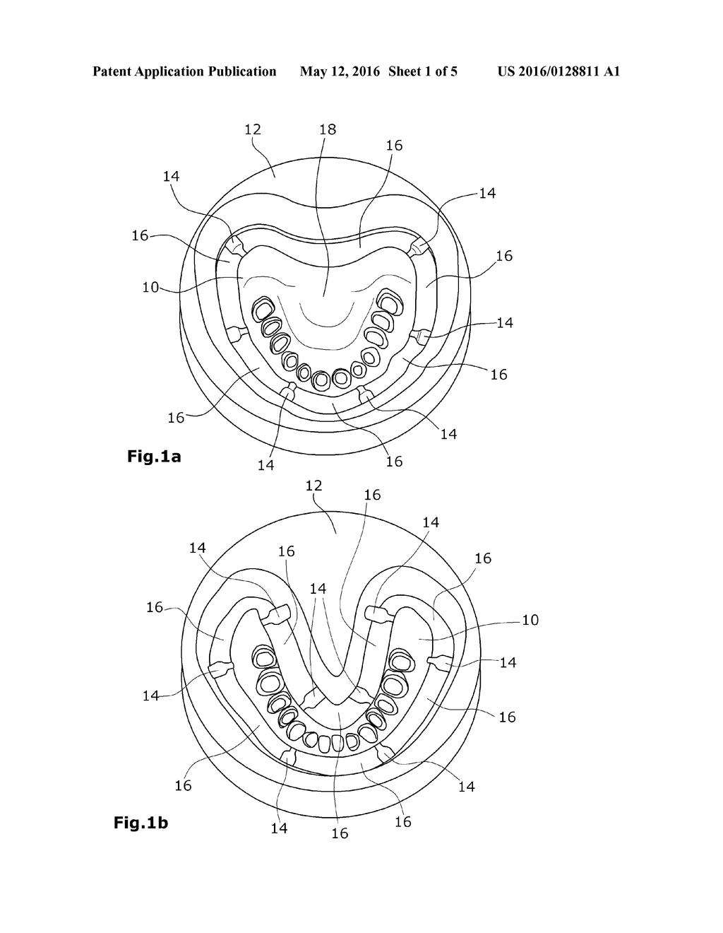 PROSTHETIC PREFORM FOR PRODUCING A DENTAL PROSTHETIC BODY - diagram, schematic, and image 02