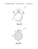 METHOD OF TREATING PROLAPSE OF A VAGINA BY PROVIDING A REINFORCING IMPLANT     INSIDE OF THE VAGINA diagram and image