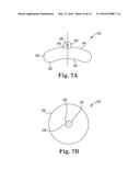 METHOD OF TREATING PROLAPSE OF A VAGINA BY PROVIDING A REINFORCING IMPLANT     INSIDE OF THE VAGINA diagram and image