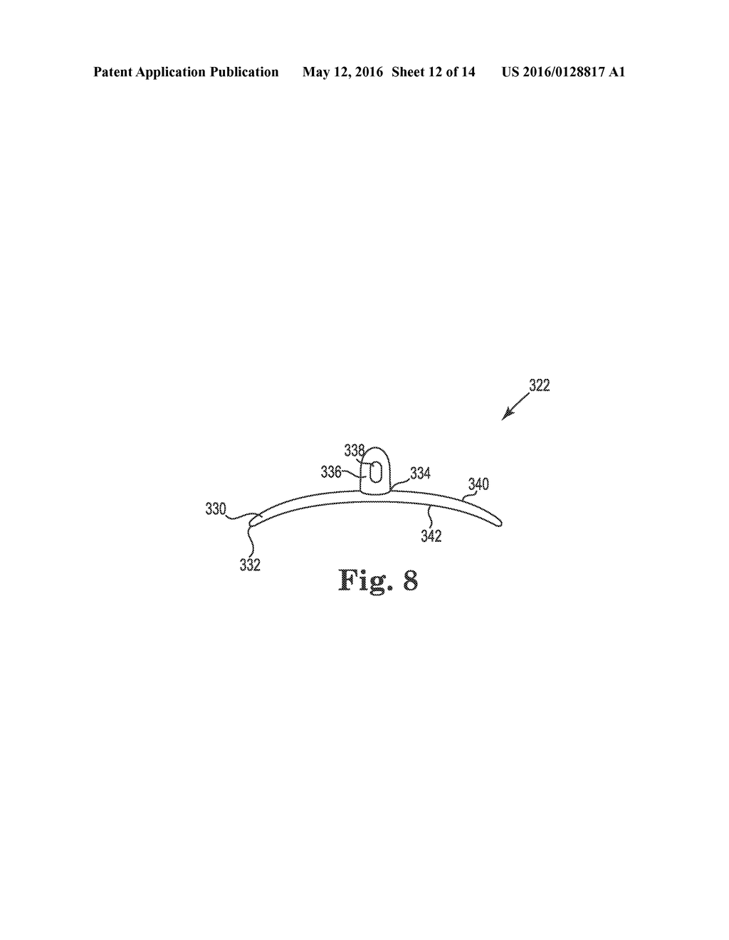 METHOD OF TREATING PROLAPSE OF A VAGINA BY PROVIDING A REINFORCING IMPLANT     INSIDE OF THE VAGINA - diagram, schematic, and image 13