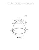 METHOD OF TREATING PROLAPSE OF A VAGINA BY PROVIDING A REINFORCING IMPLANT     INSIDE OF THE VAGINA diagram and image