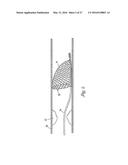 HOLDING ZONE FOR INTRAVASCULAR MEDICAL DEVICE diagram and image