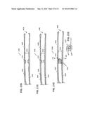 HOLDING ZONE FOR INTRAVASCULAR MEDICAL DEVICE diagram and image