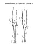 HOLDING ZONE FOR INTRAVASCULAR MEDICAL DEVICE diagram and image