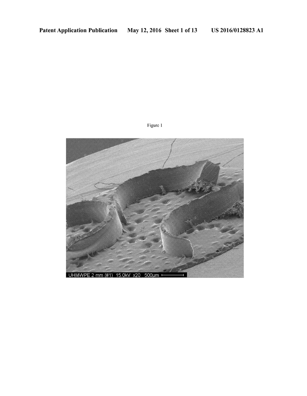 POROUS IMPLANT MATERIALS AND RELATED METHODS - diagram, schematic, and image 02