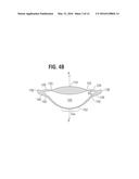 ACCOMMODATING INTRAOCULAR LENS diagram and image