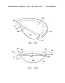 ACCOMMODATING INTRAOCULAR LENS diagram and image