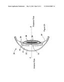 ACCOMMODATING INTRAOCULAR LENS PROVIDING PROGRESSIVE POWER CHANGE diagram and image