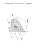 ACCOMMODATING INTRAOCULAR LENS PROVIDING PROGRESSIVE POWER CHANGE diagram and image