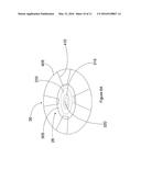 ACCOMMODATING INTRAOCULAR LENS PROVIDING PROGRESSIVE POWER CHANGE diagram and image