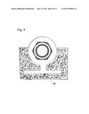 SCAFFOLD IMPLANT SYSTEM diagram and image