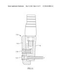 SCAFFOLD IMPLANT SYSTEM diagram and image