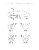 BALL AND SOCKET ASSEMBLY diagram and image