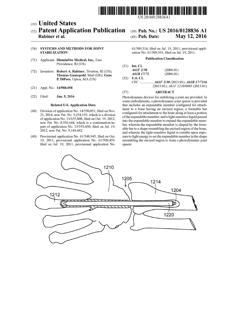 Systems and Methods for Joint Stabilization - diagram, schematic, and image 01