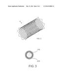 DRUG-ELUTING MEDICAL IMPLANTS diagram and image