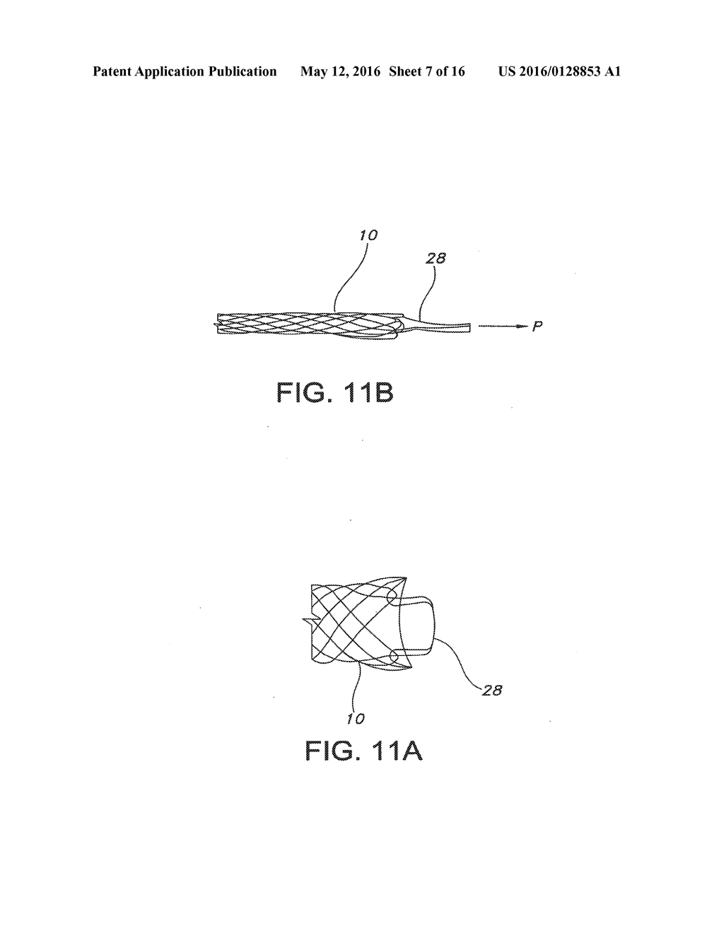 INTEGRATED STENT REPOSITIONING AND RETRIEVAL LOOP - diagram, schematic, and image 08