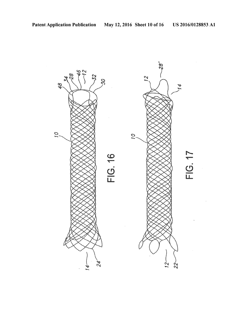 INTEGRATED STENT REPOSITIONING AND RETRIEVAL LOOP - diagram, schematic, and image 11