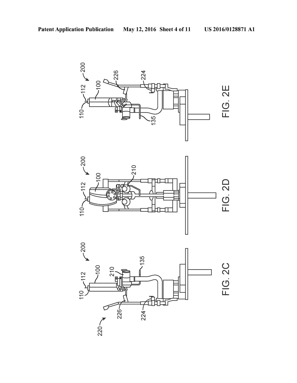 Grid Pattern Laser Treatment and Methods - diagram, schematic, and image 05