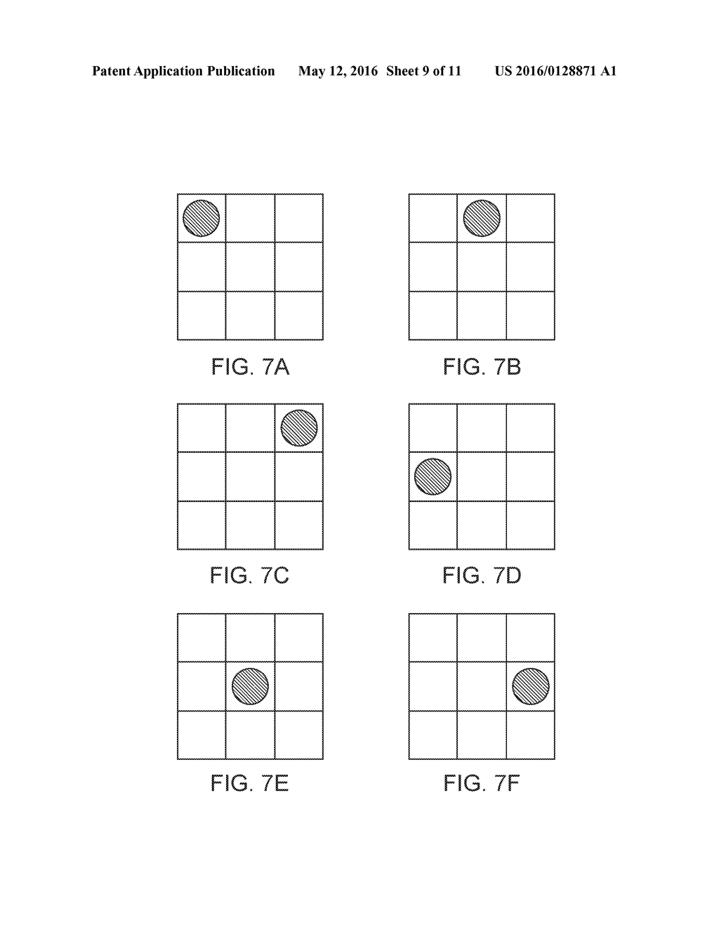 Grid Pattern Laser Treatment and Methods - diagram, schematic, and image 10