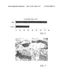 CYTOTOXIC SUBSTANCE FOR USE IN COMBINATION WITH RADIOTHERAPY IN CANCER     TREATMENT diagram and image