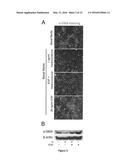 USE OF MESOTHELIAL CELLS IN TISSUE BIOENGINEERING AND ARTIFICIAL TISSUES diagram and image