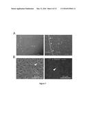 USE OF MESOTHELIAL CELLS IN TISSUE BIOENGINEERING AND ARTIFICIAL TISSUES diagram and image